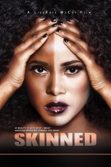 Skinned poster